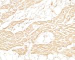 Myoglobin Antibody in Immunohistochemistry (Paraffin) (IHC (P))