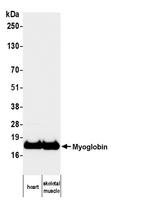 Myoglobin Antibody in Western Blot (WB)