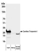 Cardiac Troponin I Antibody in Western Blot (WB)