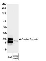 Cardiac Troponin I Antibody in Western Blot (WB)