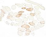 Skeletal Troponin I Antibody in Immunohistochemistry (Paraffin) (IHC (P))