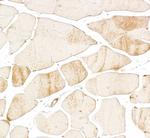 Skeletal Troponin I Antibody in Immunohistochemistry (Paraffin) (IHC (P))