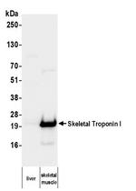 Skeletal Troponin I Antibody in Western Blot (WB)