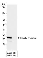 Skeletal Troponin I Antibody in Western Blot (WB)