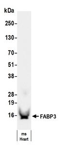 FABP3 Antibody in Western Blot (WB)