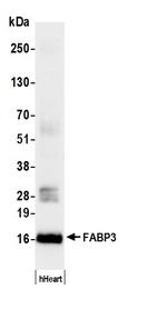 FABP3 Antibody in Western Blot (WB)