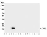 FABP3 Antibody in Western Blot (WB)