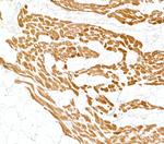 Cardiac Troponin I Antibody in Immunohistochemistry (Paraffin) (IHC (P))