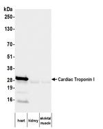 Cardiac Troponin I Antibody in Western Blot (WB)