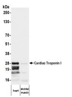 Cardiac Troponin I Antibody in Western Blot (WB)