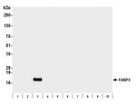 FABP3 Antibody in Western Blot (WB)