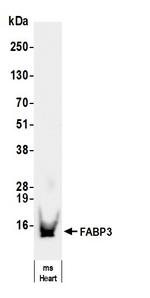 FABP3 Antibody in Western Blot (WB)