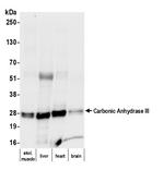 Carbonic Anhydrase III Monoclonal Antibody (2CA-4)