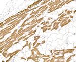 Myosin Light Chain 1 Antibody in Immunohistochemistry (Paraffin) (IHC (P))