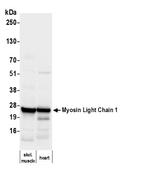 Myosin Light Chain 1 Antibody in Western Blot (WB)