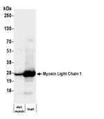 Myosin Light Chain 1 Antibody in Western Blot (WB)