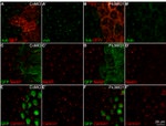 GFP Antibody in Immunocytochemistry (ICC/IF)