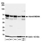 HdmX/MDM4 Recombinant Rabbit Monoclonal Antibody (BL-3-2F2)