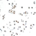 CDK7 Recombinant Rabbit Monoclonal Antibody (BL-80-5D4)