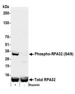 Phospho-RPA32 (Ser4, Ser8) Antibody in Western Blot (WB)