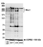 MLL1 Recombinant Rabbit Monoclonal Antibody (BL-175-7E8)