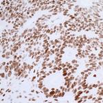 53BP1 Antibody in Immunohistochemistry (Paraffin) (IHC (P))