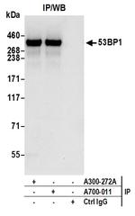 53BP1 Antibody in Immunoprecipitation (IP)