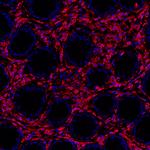 CD45 Antibody in Immunohistochemistry (Paraffin) (IHC (P))