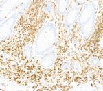 CD45 Antibody in Immunohistochemistry (Paraffin) (IHC (P))