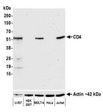 CD4 Antibody in Western Blot (WB)