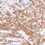 CD3E Antibody in Immunohistochemistry (Paraffin) (IHC (P))
