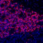 CD3E Antibody in Immunohistochemistry (Paraffin) (IHC (P))