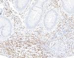 CD247/CD3Z Antibody in Immunohistochemistry (Paraffin) (IHC (P))