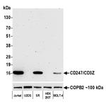 CD247/CD3Z Antibody in Western Blot (WB)