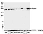 PBRM1 Antibody in Western Blot (WB)