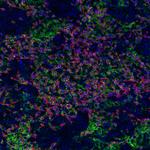 PD-L1 Antibody in Immunocytochemistry (ICC/IF)