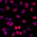 Ki-67 Antibody in Immunocytochemistry (ICC/IF)