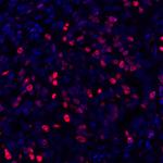 Ki-67 Antibody in Immunohistochemistry (Paraffin) (IHC (P))