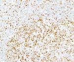 Ki-67 Antibody in Immunohistochemistry (Paraffin) (IHC (P))