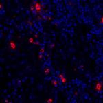 Granzyme B Antibody in Immunohistochemistry (Paraffin) (IHC (P))