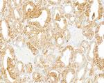B7-H3/CD276 Antibody in Immunohistochemistry (Paraffin) (IHC (P))
