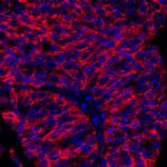 B7-H3/CD276 Antibody in Immunohistochemistry (Paraffin) (IHC (P))