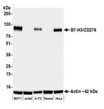 B7-H3/CD276 Antibody in Western Blot (WB)