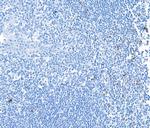 LAG3 Antibody in Immunohistochemistry (Paraffin) (IHC (P))
