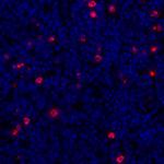 LAG3 Antibody in Immunohistochemistry (Paraffin) (IHC (P))