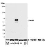 LAG3 Antibody in Western Blot (WB)