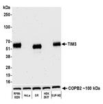 TIM3 Antibody in Western Blot (WB)