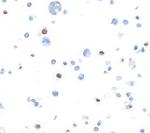 FOXP3 Antibody in Immunocytochemistry (ICC/IF)