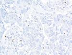 FOXP3 Antibody in Immunohistochemistry (Paraffin) (IHC (P))