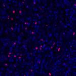 FOXP3 Antibody in Immunohistochemistry (Paraffin) (IHC (P))